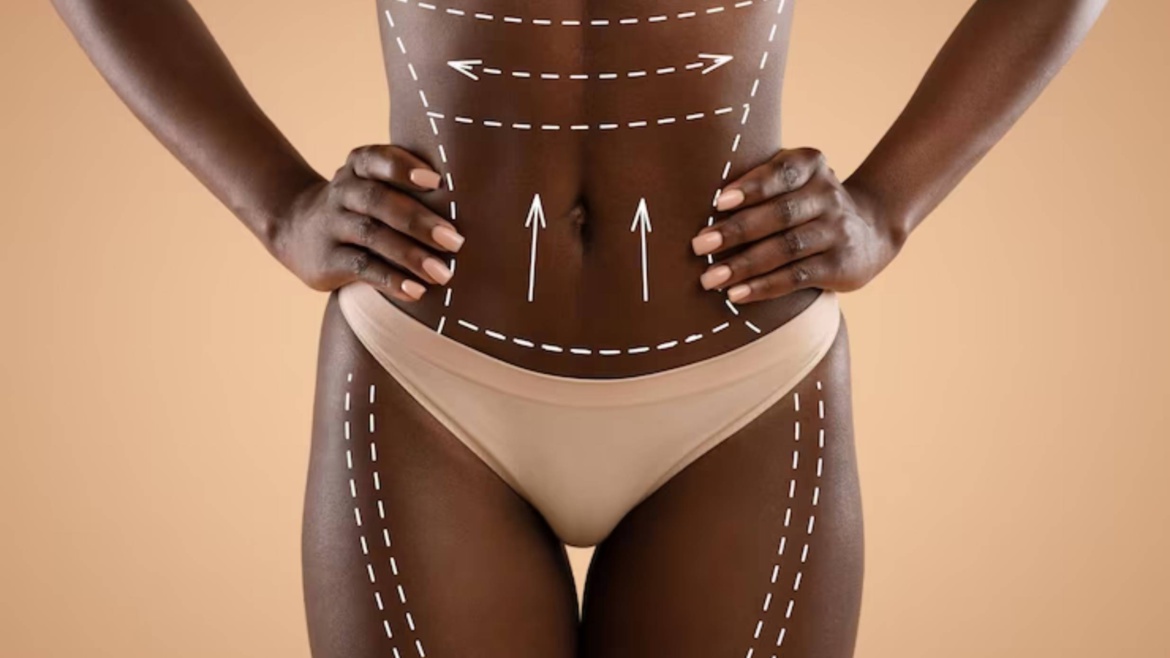 Brazilian Waxing